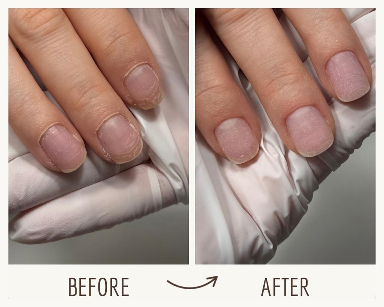 Before and after: overgrown cuticles and a clean cuticle line after a Russian manicure